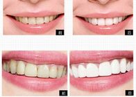 Sistema privado del blanqueo del diente de los productos del cuidado personal del logotipo para los dientes caseros que blanquean